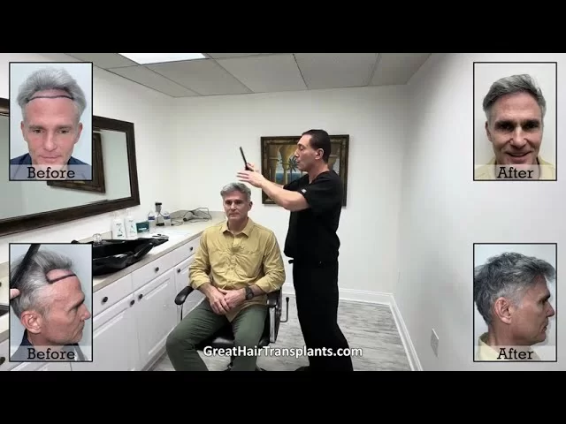 Dr. Brett Bolton MaxHarvest Procedure patient James