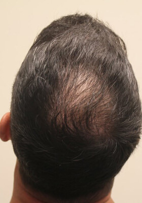 Crown 9 Months