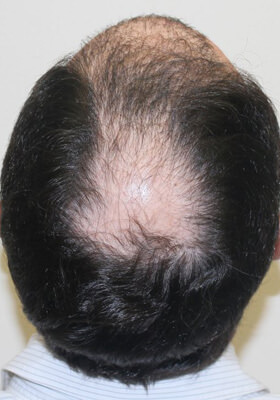 Crown Before