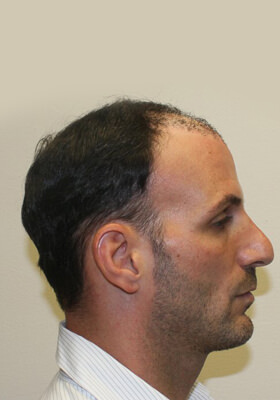 Nick Alberto Right Before