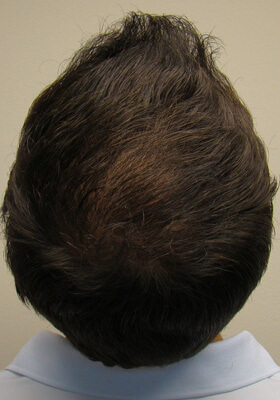 Ryan Crown 1 Year