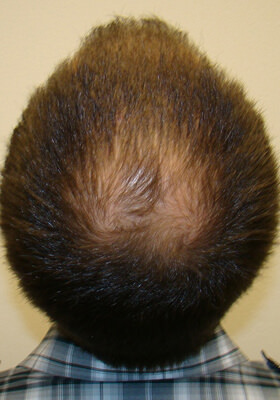 Ryan Crown Before