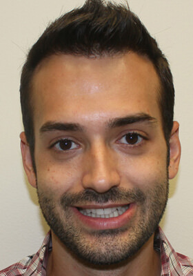 Ryan Front Procedure 2