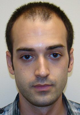 Ryan Front Before