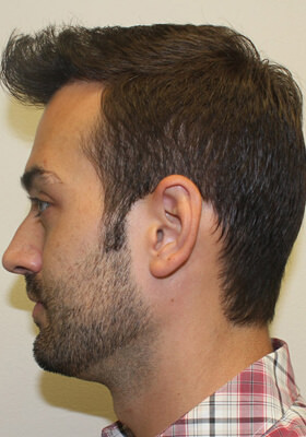Ryan Left Procedure 2