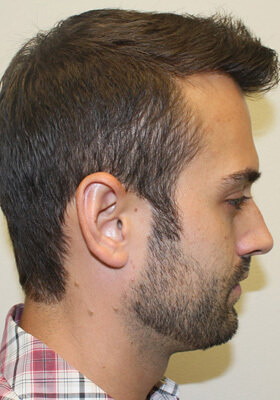 Ryan Right Procedure 2