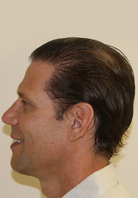 Left 10 Months