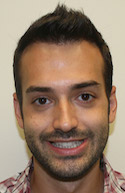 Ryan Front View After Second Procedure