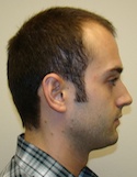 Ryan Right View Before