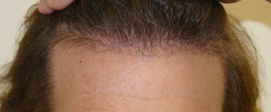 Continued Growth
