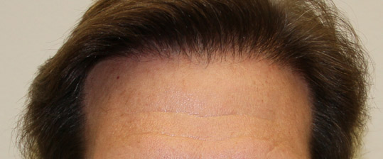 Maturing Results