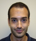 Ryan Hair Transplant Front View 6 Months