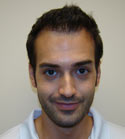 Ryan Hair Transplant Front View 8 Months