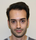 Ryan Hair Transplant 9 Month Progress